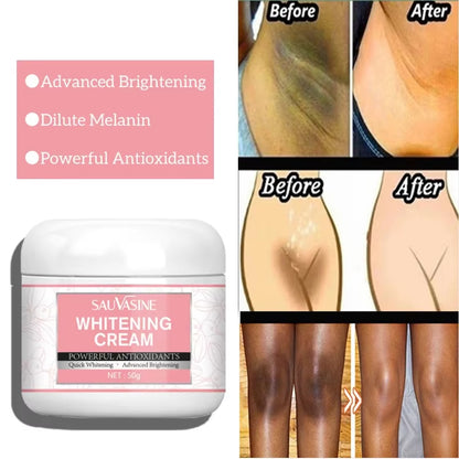 Skin Whitening Cream Day Cream Beauty Health for Underarms Armpit Knees Private Parts and Body Dark Spot Skin Care Maquillaje